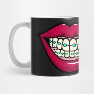 Big Smile with braces Mug